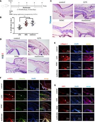 Eye Drops of Metformin Prevents Fibrosis After Glaucoma Filtration Surgery in Rats via Activating AMPK/Nrf2 Signaling Pathway